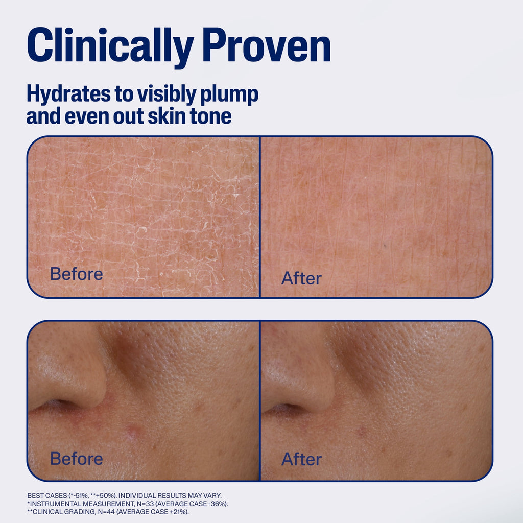 CETAPHIL Repair & Renew PM Face Serum for Stressed Sensitive Skin, Hyaluronic Acid and Powerful Anxtioxidants, 1 fl oz