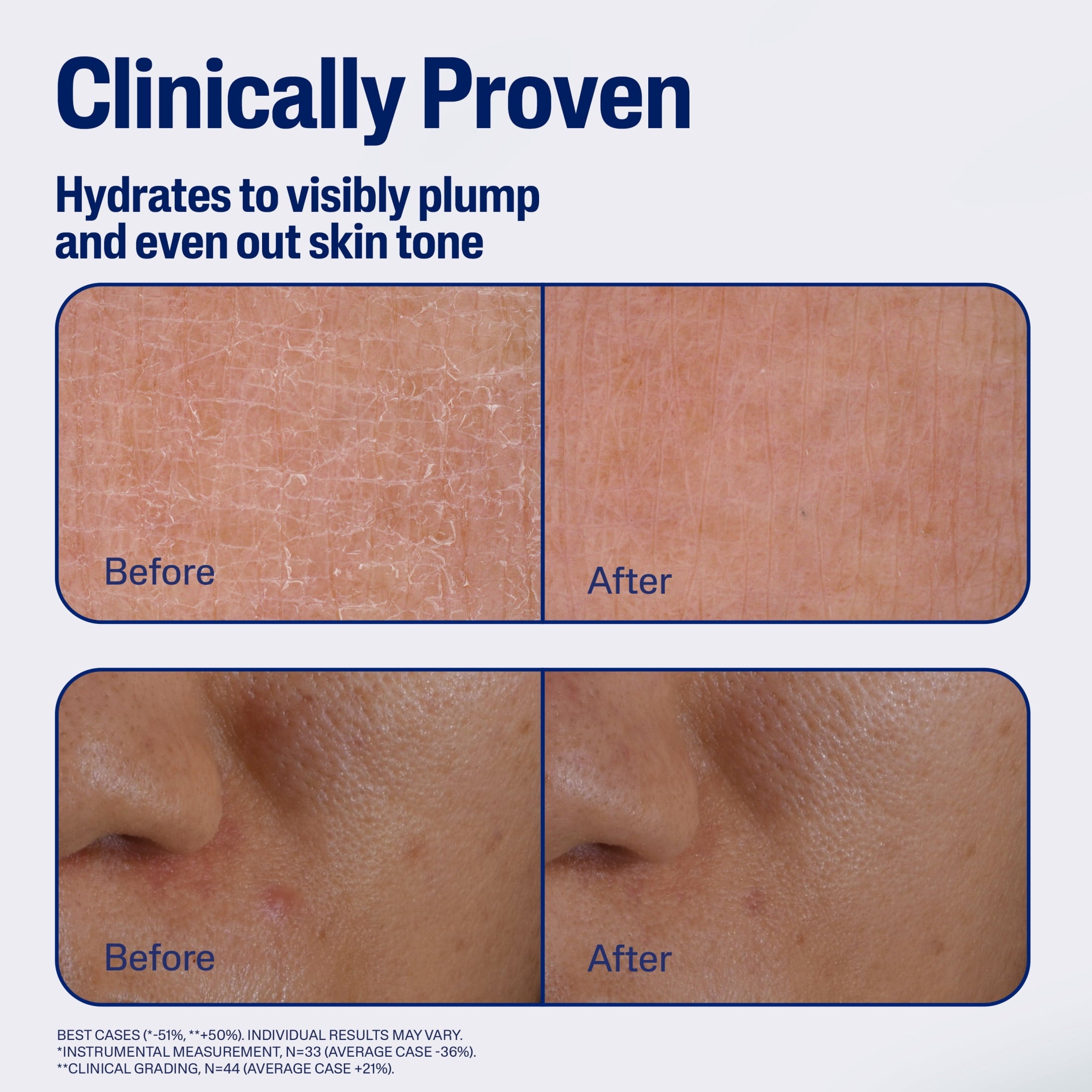 CETAPHIL Repair & Renew PM Face Serum for Stressed Sensitive Skin, Hyaluronic Acid and Powerful Anxtioxidants, 1 fl oz