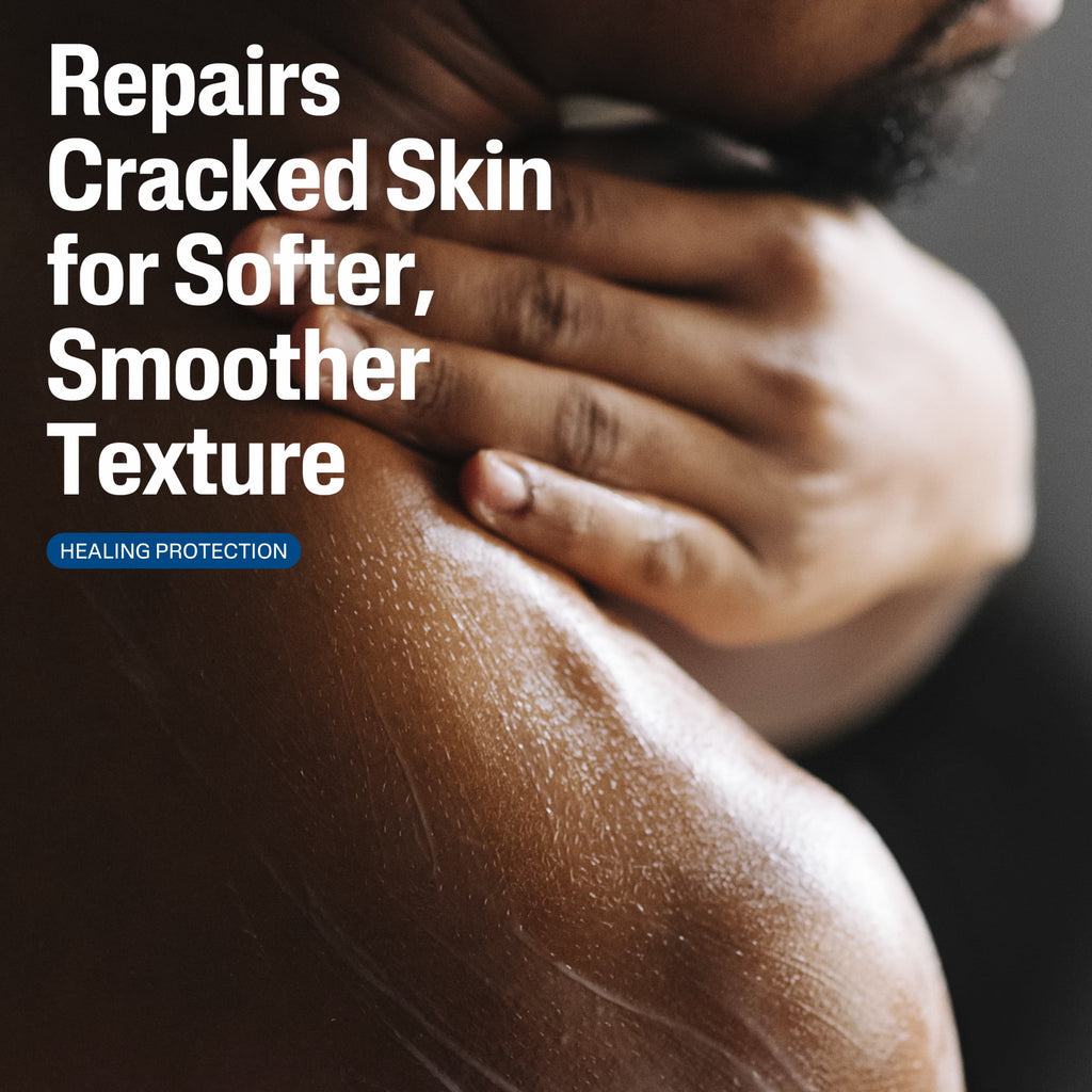 Cetaphil Skin Repair Lotion for Very Rough Cracked Skin, Unscented, 16 fl oz
