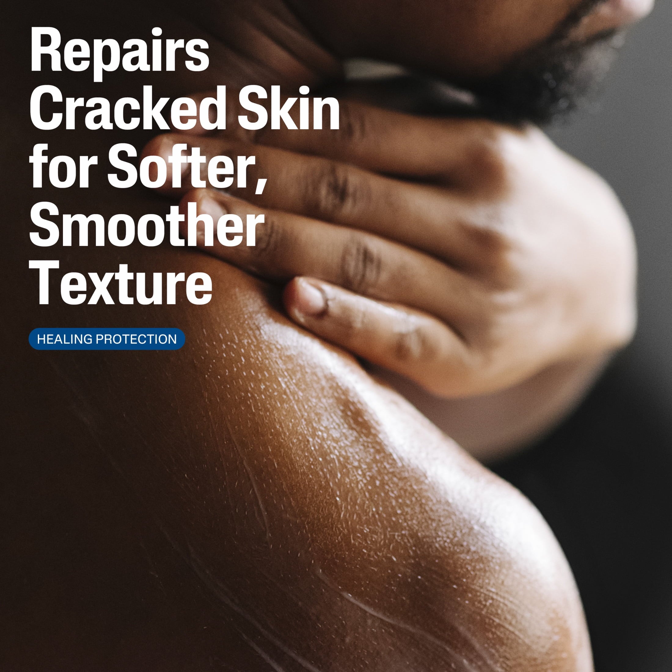 Cetaphil Skin Repair Lotion for Very Rough Cracked Skin, Unscented, 16 fl oz