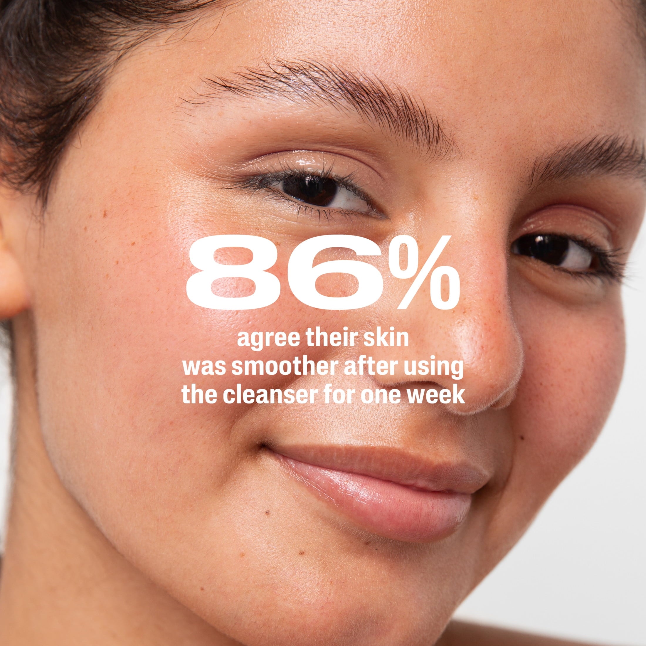 Cetaphil Gentle Clear Complexion-Clearing BPO Acne Cleanser for Sensitive Skin, 4.2 fl oz