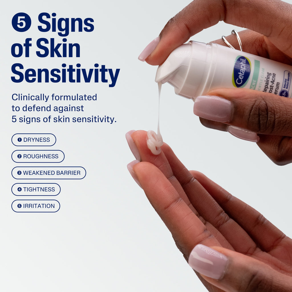 Cetaphil Gentle Clear Repairing Post-Acne Serum, Retinol Alternative, Oil Free Serum, Acne-Prone Skin, 1 fl oz